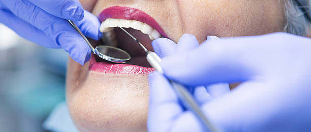 Best Chipped Tooth Repair Near Me  in Sebree, KY